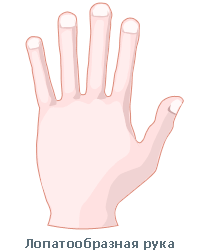  Лопатообразная рука 5